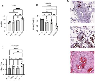 Moderate hypoxia induces metabolic divergence in circulating monocytes and tissue resident macrophages from Berkeley sickle cell anemia mice